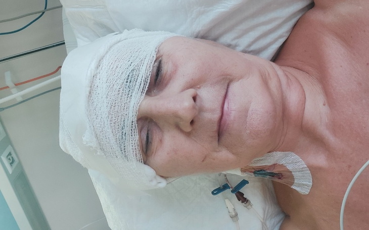 Zbiórka Teresa, Leczenie glejaka - zdjęcie główne