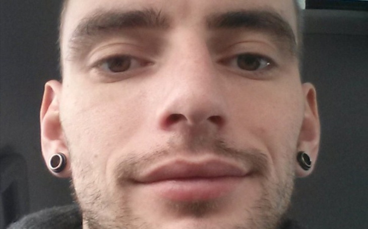 Zbiórka Operacja zapobiegająca migrena - zdjęcie główne