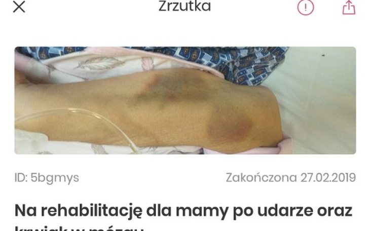 Zbiórka Leczenie po krwotoku srodmozgowy - zdjęcie główne