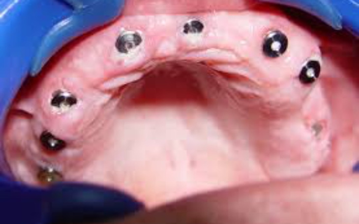 Zbiórka Pomóżcie odzyskać mi uśmiech - zdjęcie główne