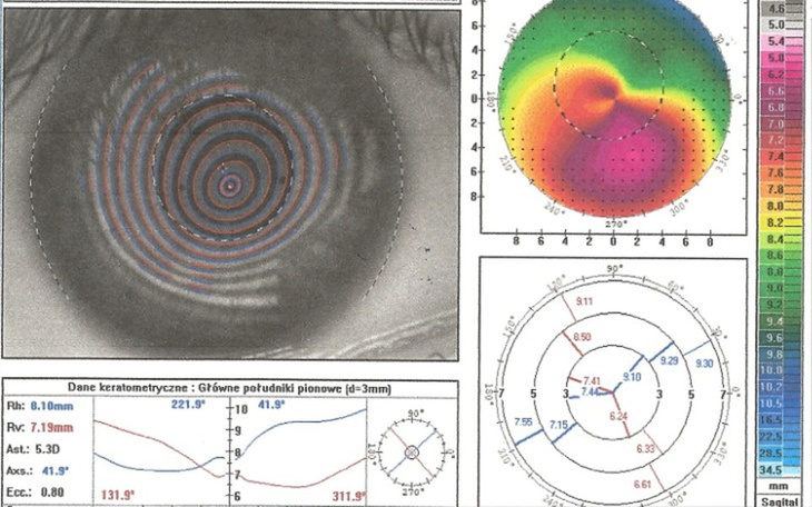 Zbiórka Pomoc dla chorego twórcy LMV - zdjęcie główne