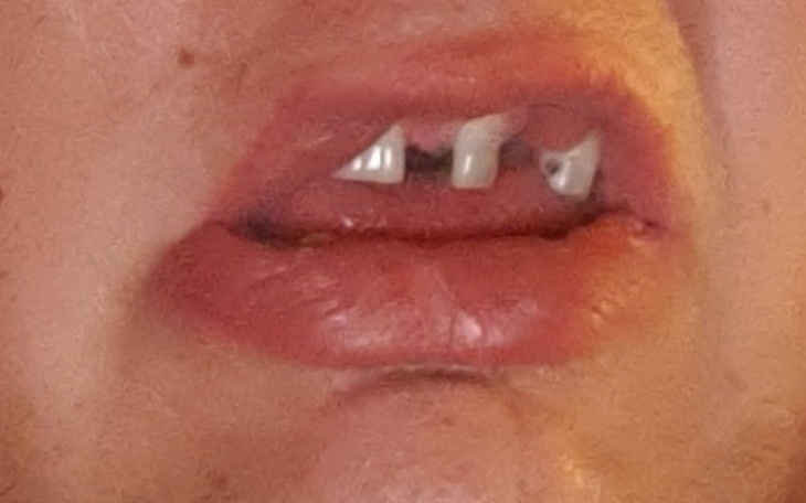 Zbiórka podaruj mi uśmiech zabrany przez - zdjęcie główne