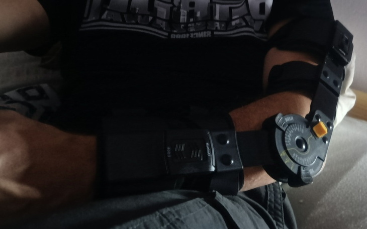 Zbiórka Na leczenie kolana i ręki - zdjęcie główne