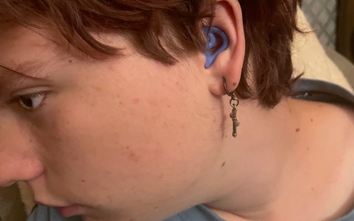 Zbiórka Operacja mojego brata na uszy - zdjęcie główne