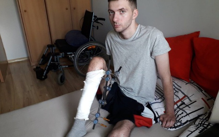 Zbiórka Proteza nogi oraz rehabilitacja - zdjęcie główne