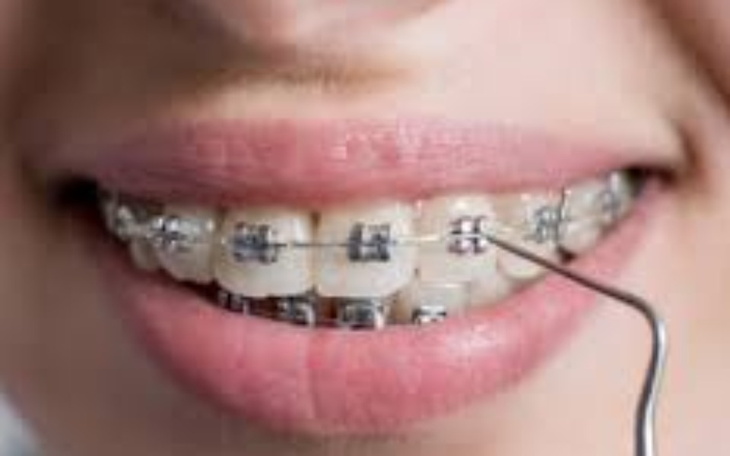 Zbiórka zbiórka na wymarzony uśmiech - zdjęcie główne