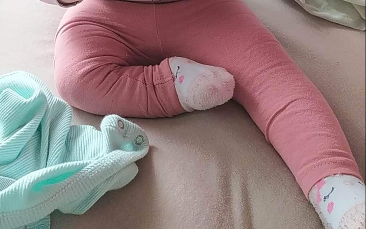 Zbiórka Antonina HEMIMELIA PISZCZELOWA - zdjęcie główne