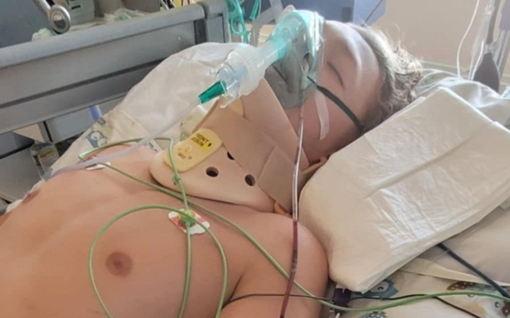 Chłopiec leżący w szpitalu z rurkami i monitorami.