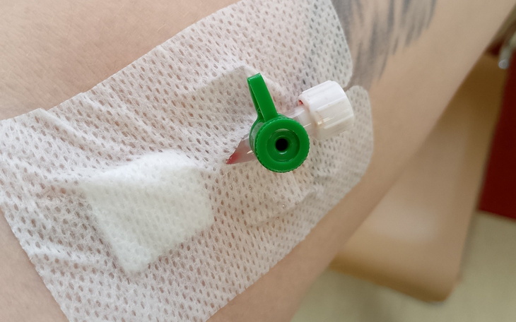 Zdjęcie opatrunku na nodze, igła w ciele.