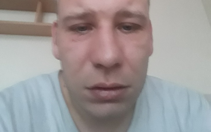 Zbiórka Zbiórka dla Michała Kubiaka - zdjęcie główne