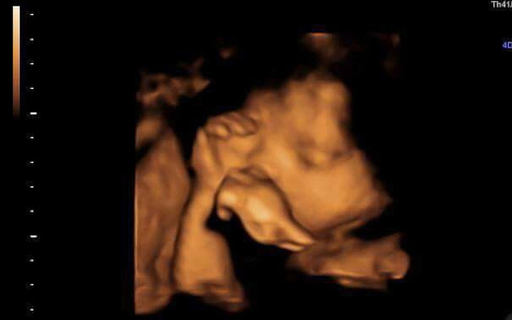 Zbiórka Brakuje mi na akcesoria dla córc - zdjęcie główne