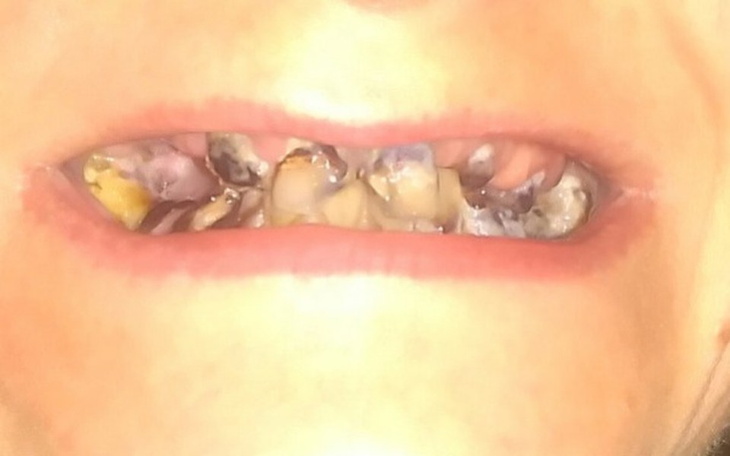 Zbiórka pomoc dla naszej mamy 😢 - zdjęcie główne