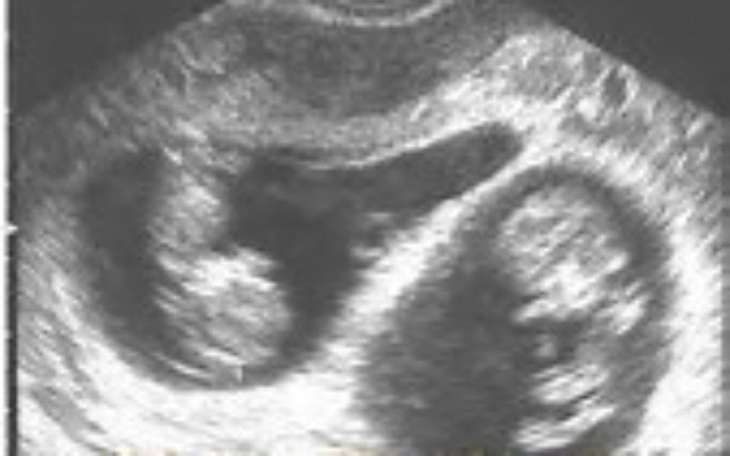 Zbiórka Wyposazenie dla dzieci - zdjęcie główne