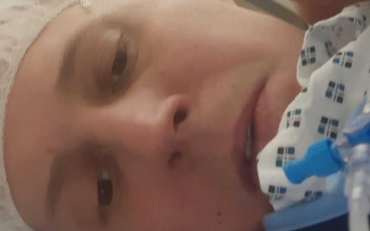 Zbiórka Mam złamane oba barki. Pomóżcie - zdjęcie główne