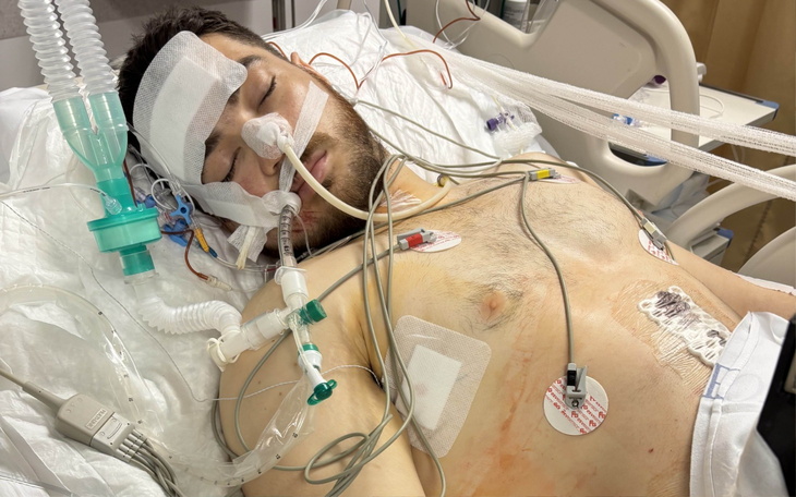 Mężczyzna w szpitalu, podłączony do aparatury medycznej.