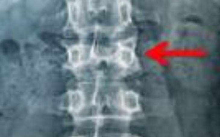 Zbiórka Pęknięty krąg - zdjęcie główne