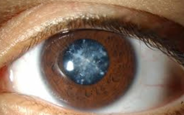 Zbiórka Operacja Zaćmy Szwagra - zdjęcie główne