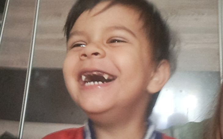 Zbiórka Na leczenie zębów synka - zdjęcie główne