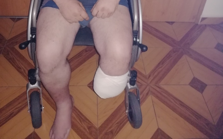 Zbiórka Remont mieszkania i protezowanie - zdjęcie główne