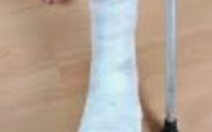 Zbiórka Na złamaną noge - zdjęcie główne