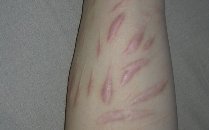 Zbiórka Pomóżmy Lenie - zdjęcie główne