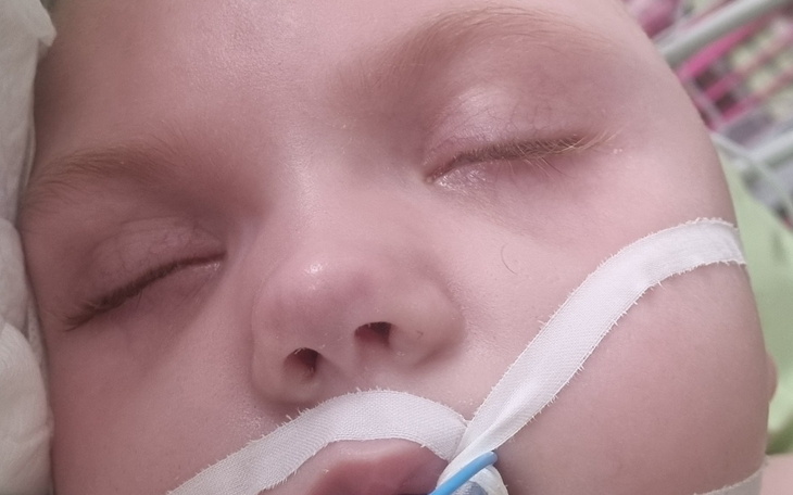 Małe dziecko w szpitalu, z rurkami tlenowymi i zamkniętymi oczami.