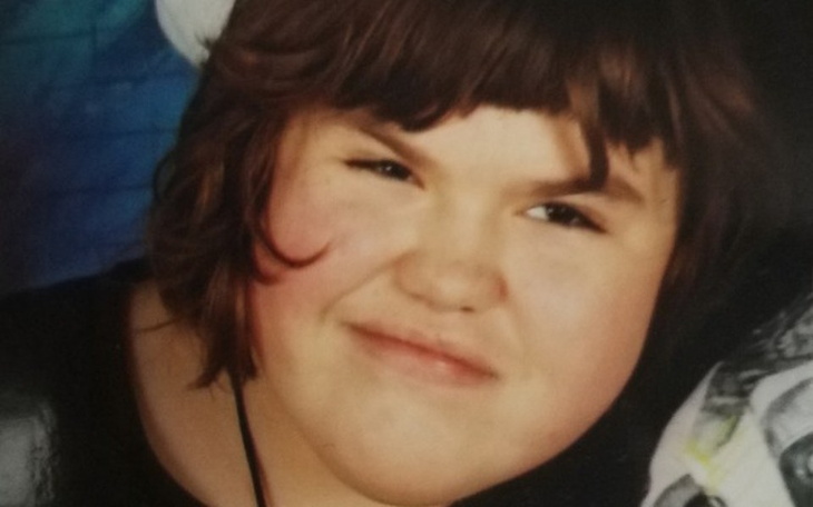 Zbiórka Leczenie Alicji z Krainy Uśmiech - zdjęcie główne