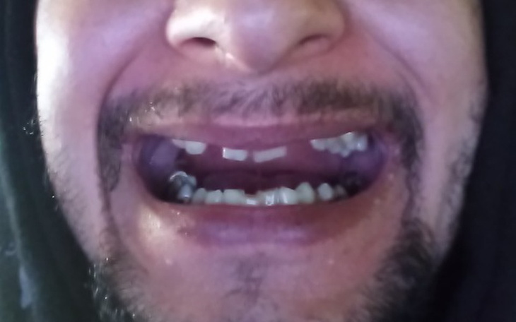 Zbiórka Piękny uśmiech i pewność siebie - zdjęcie główne