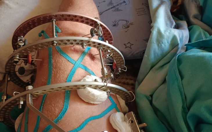 Zbiórka Pomóż mi stanąć na nogi2 - zdjęcie główne