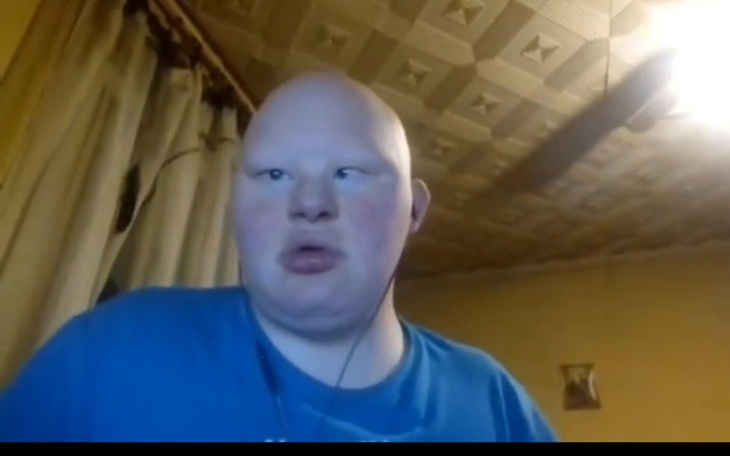 Zbiórka Na operację plastyczną mojej Twa - zdjęcie główne