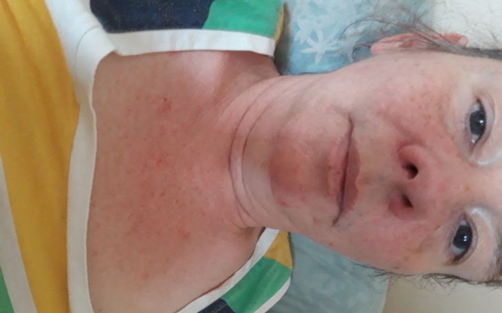 Zbiórka Rak nadnerczy - zdjęcie główne