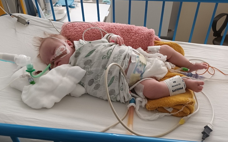 Niemowlę w szpitalnym łóżku z rurkami i monitorami.