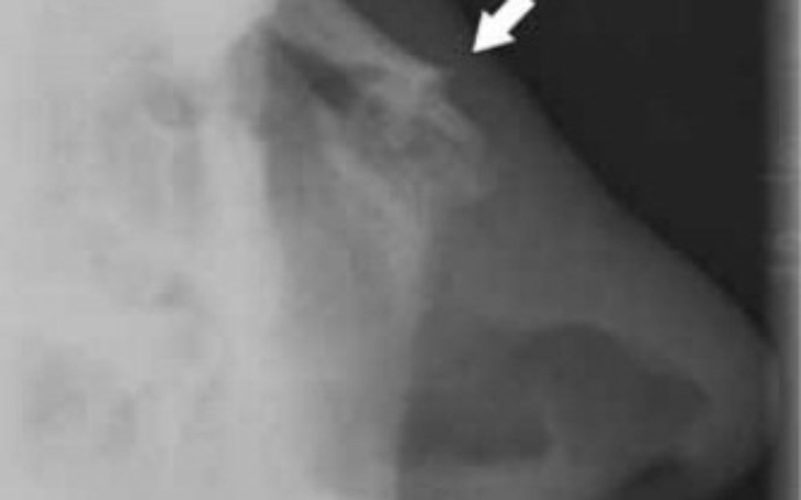 Zbiórka na operacje złamanego nosa - zdjęcie główne