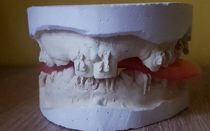 Zbiórka Chciałbym mieć piękny uśmiech - zdjęcie główne