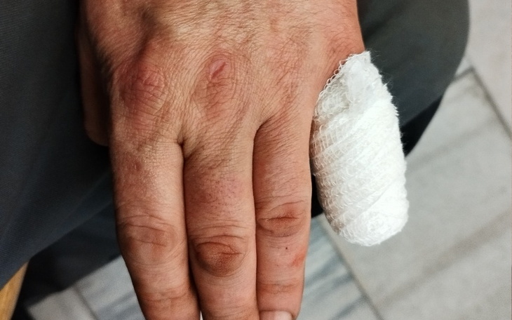 Zbiórka Wyrównanie strat - zdjęcie główne