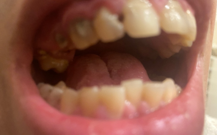 Zbiórka Na leczenie zębów u dentysty - zdjęcie główne