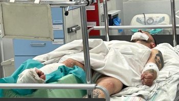 Zbiórka Skomplikowana operacja nogi - miniaturka zdjęcia
