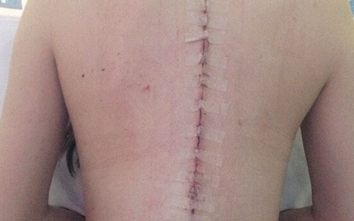 Zbiórka Życie po wypadku i rehabilitacja - zdjęcie główne