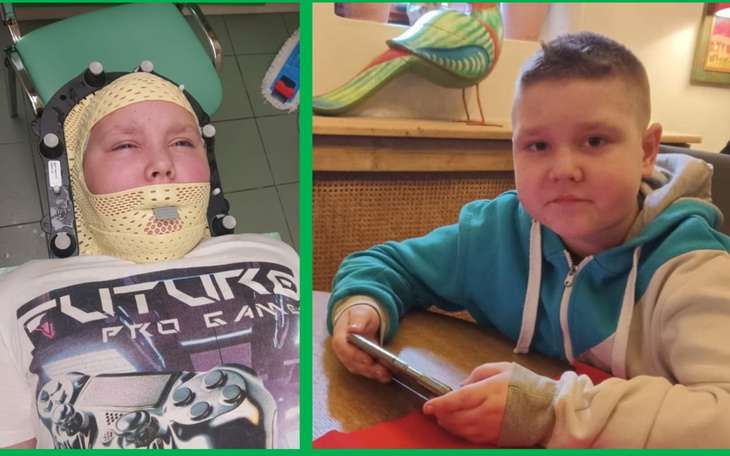 Chłopiec w specjalnym kasku, leżący na łóżku szpitalnym.