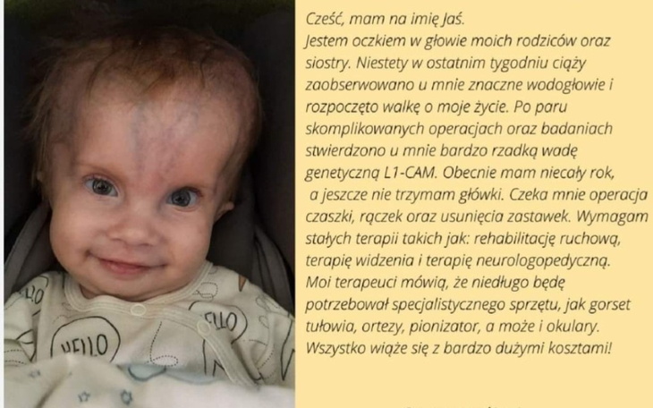 Zbiórka Pomoc dla małego Jasia - zdjęcie główne