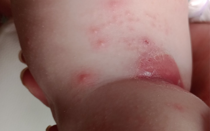 Zbiórka Na zaległe opłaty z mieszkaniem - zdjęcie główne