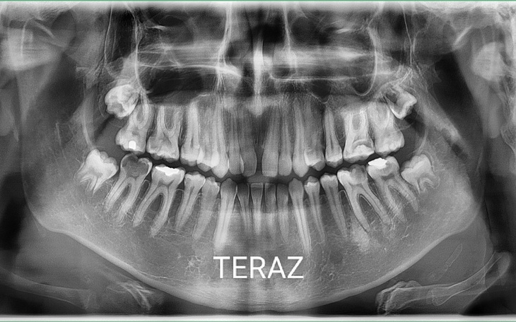 Zbiórka Zdrowy uśmiech bez strachu - zdjęcie główne