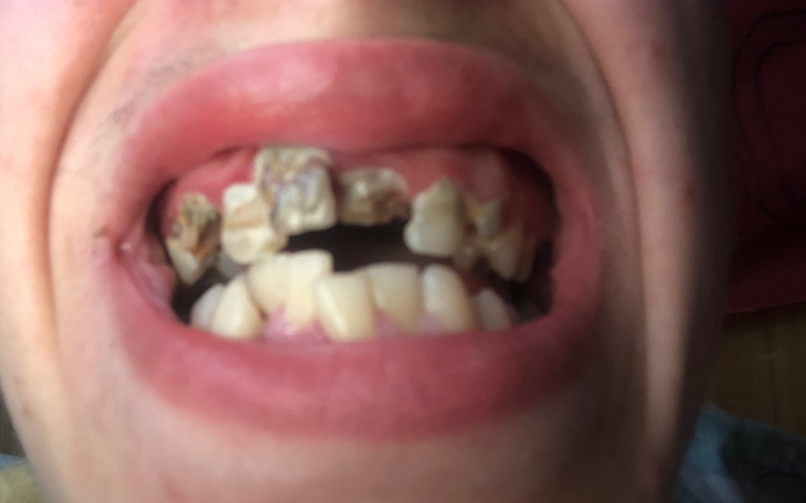 Zbiórka Górna szczeka - zdjęcie główne