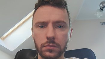 Zbiórka Przestaje chodzić pomóżcie... - miniaturka zdjęcia