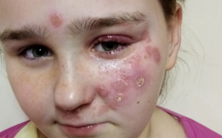 Zbiórka NA Leczenie Córeczki - zdjęcie główne