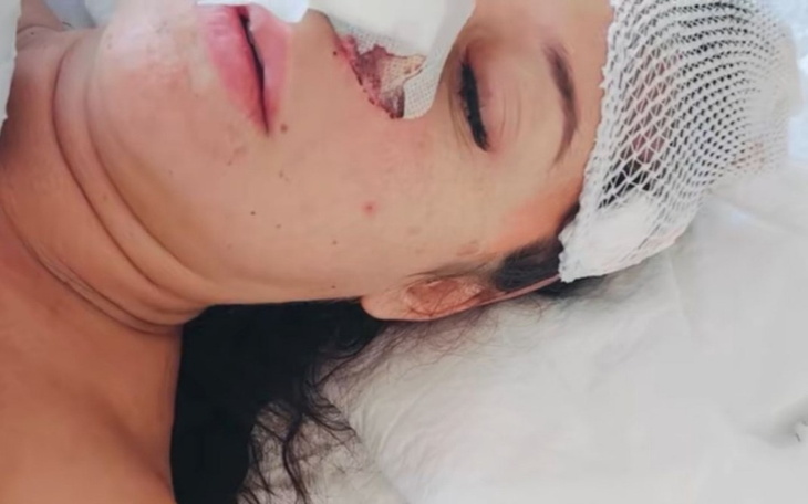 Kobieta leżąca w szpitalu, z opatrunkiem na twarzy.