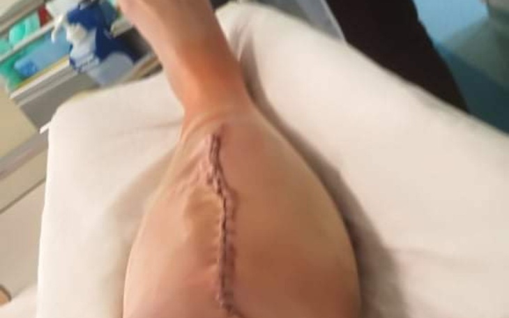 Zbiórka Na leki i rechabilitacje. - zdjęcie główne