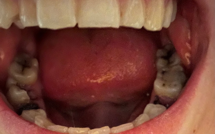 Zbiórka Leczenie zębów - bo to konieczne - zdjęcie główne