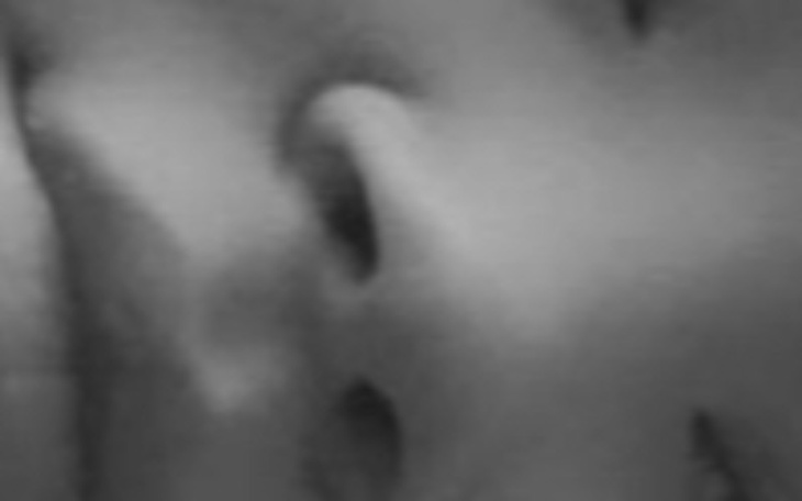 Zbiórka Pomoc dla Nikoli Ignaszczyk - zdjęcie główne