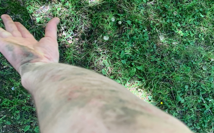 Zbiórka Zbiórka na leki i fizjoterapie - zdjęcie główne